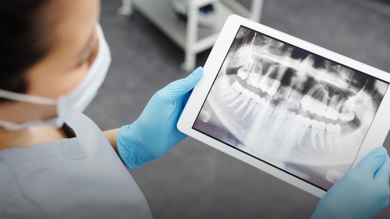 Digital Dental Radiography and what it means for you.